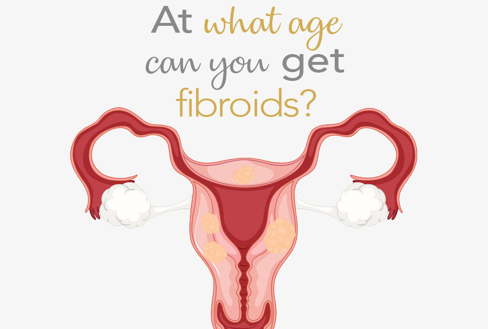 Fact Friday: At what age can you get fibroids?