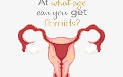 Fact Friday: At what age can you get fibroids?