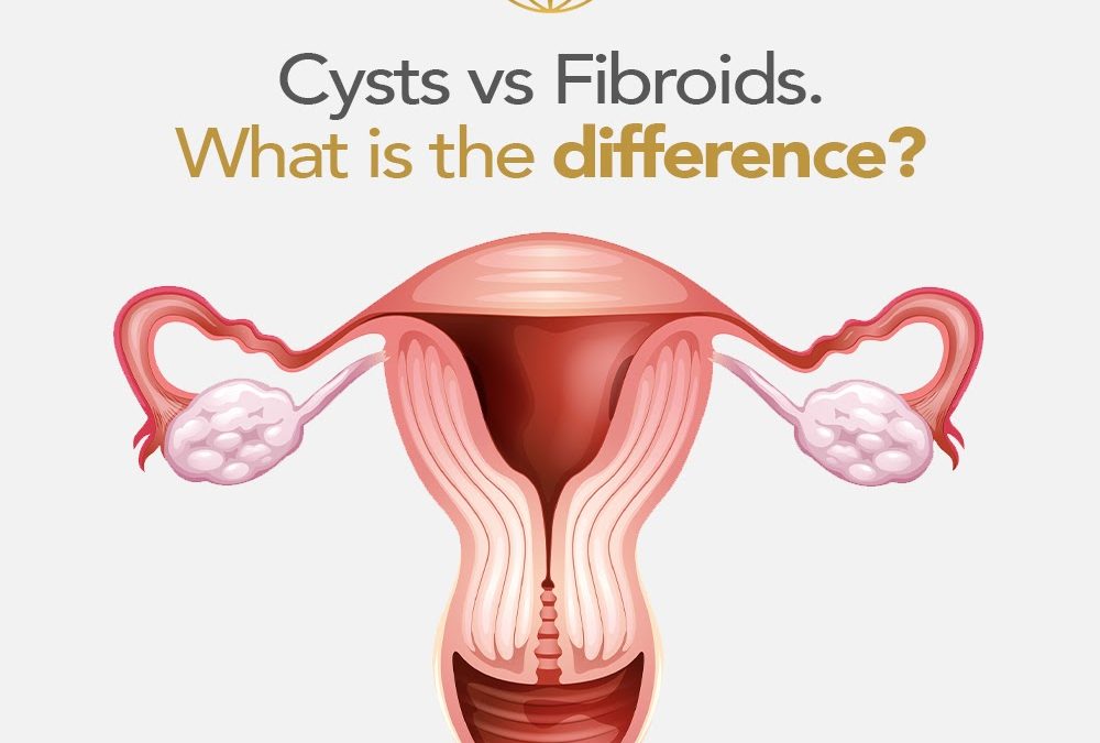 Fact Friday – Cysts vs Fibroids. What is the difference?