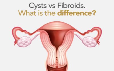Fact Friday – Cysts vs Fibroids. What is the difference?