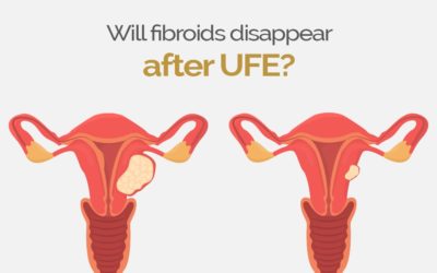Will fibroids disappear after UFE?
