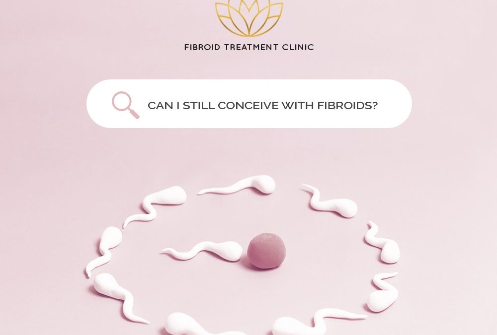Can I still conceive with fibroids?