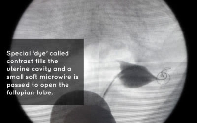 FTR procedure