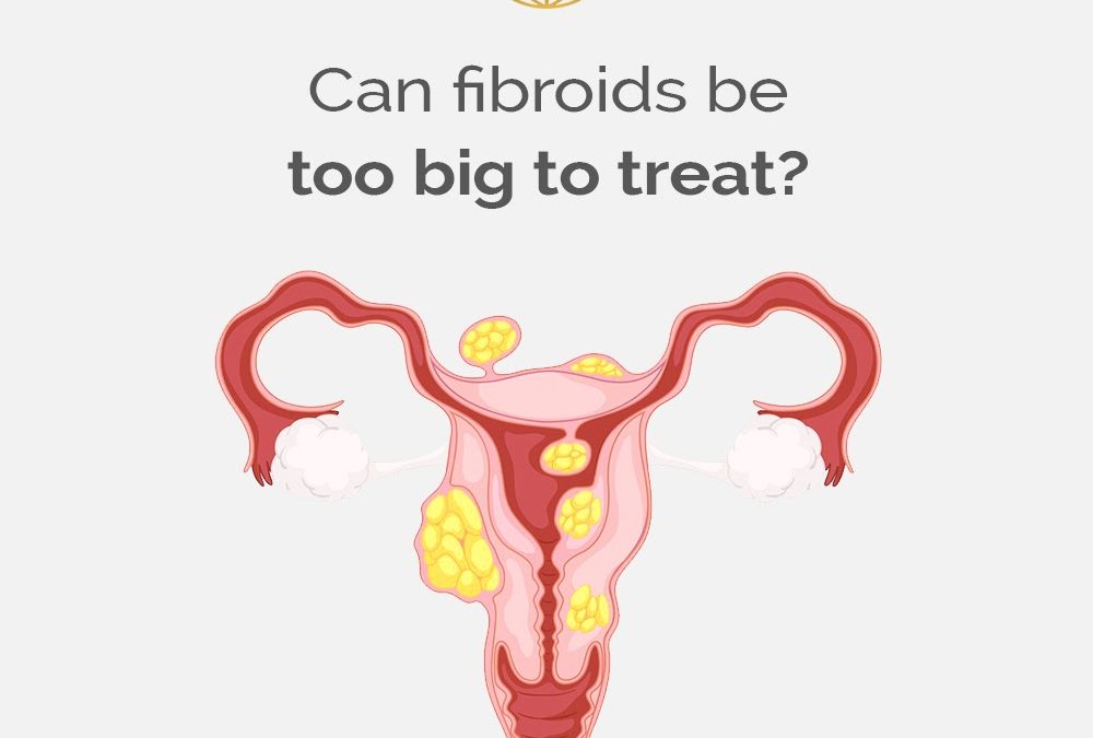 Can fibroids be too big to treat? Fibroid Treatment Clinic