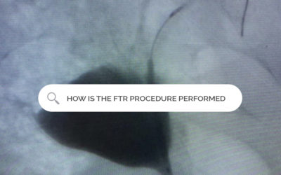 How is the FTR procedure performed?