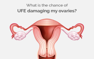 What is the chance of UFE damaging my ovaries?