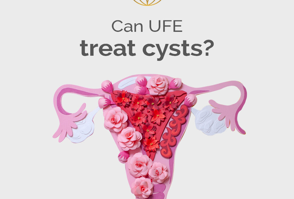 Can UFE treat cysts?