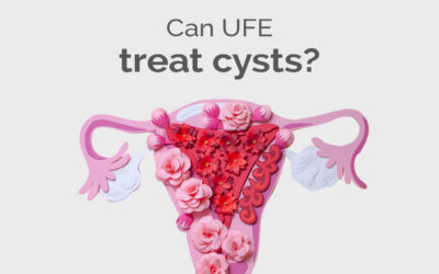 Can UFE treat cysts?