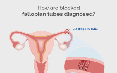 How are blocked fallopian tubes diagnosed?