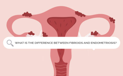 Difference between Fibroids and Endometriosis