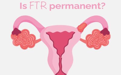 Is FTR permanent?