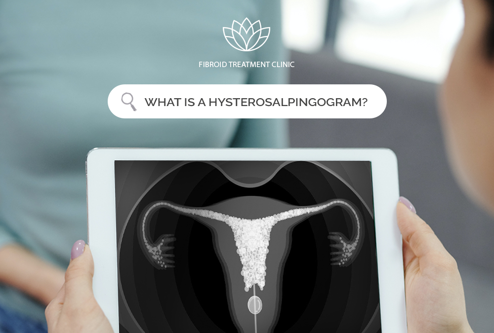 What is a hysterosalpingogram?