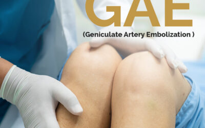 New Procedure Alert- GAE
