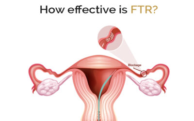 How Effective is FTR?