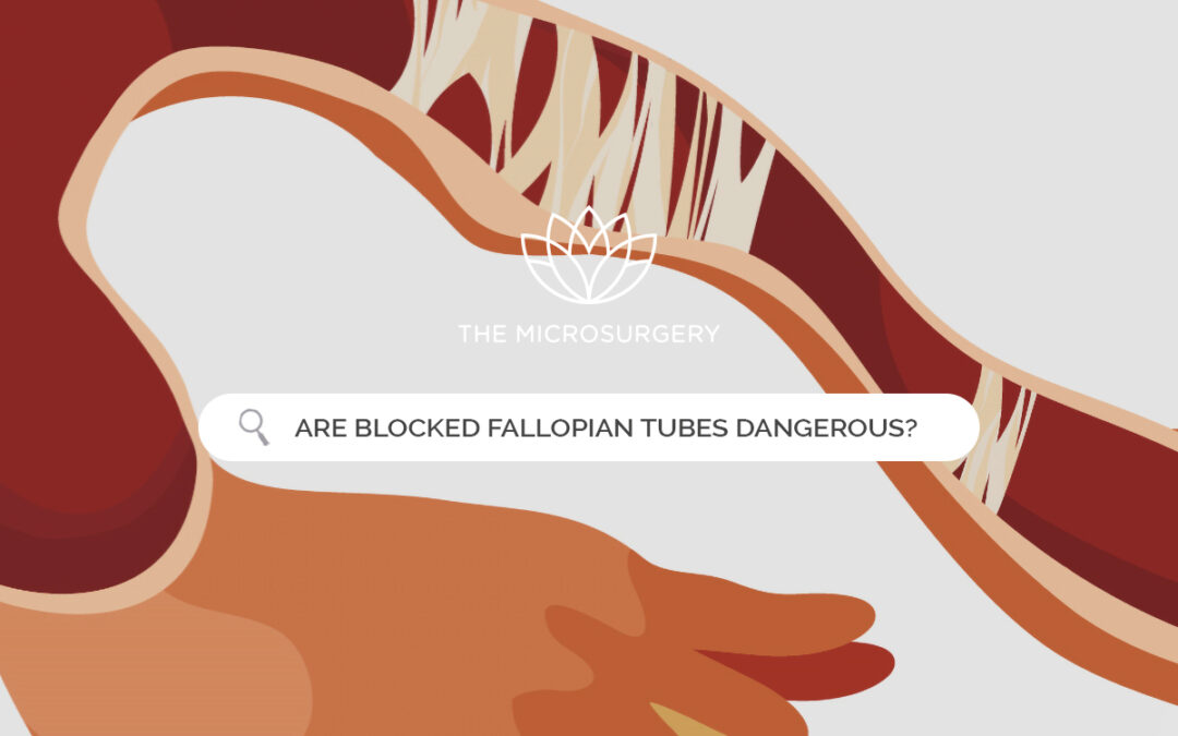 FAQ: Are blocked Fallopian tubes dangerous?