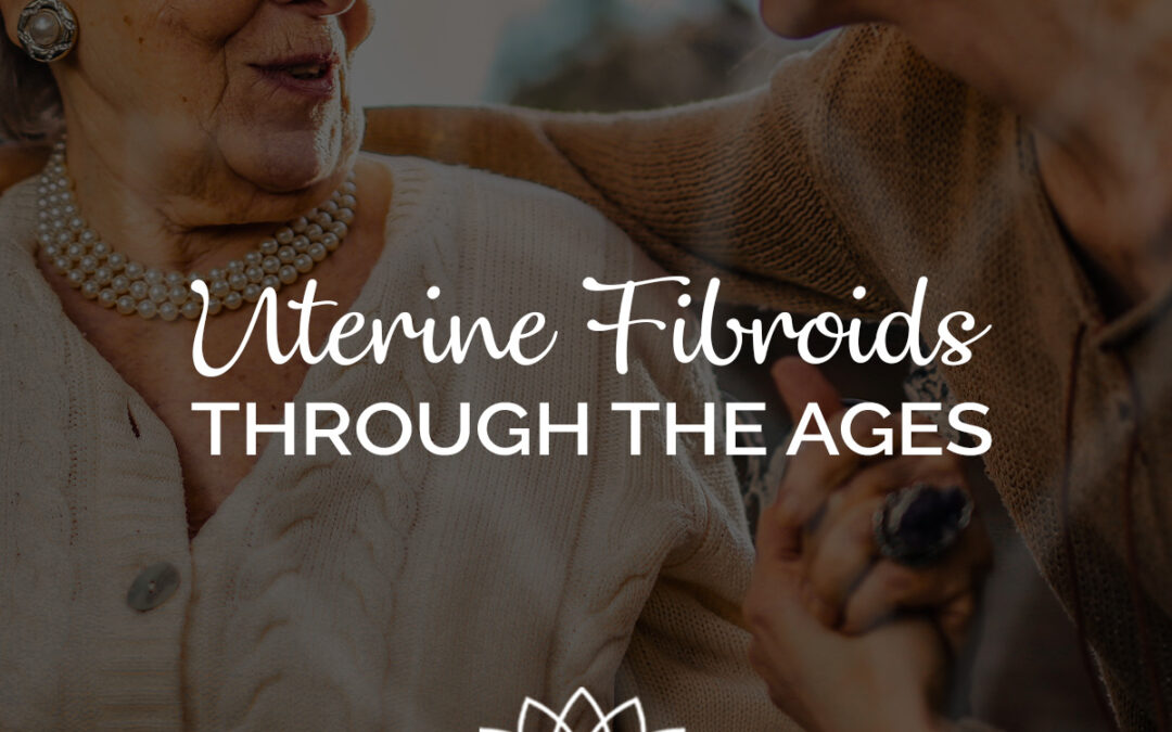 Your Age-By-Age Guide to managing Uterine Fibroids